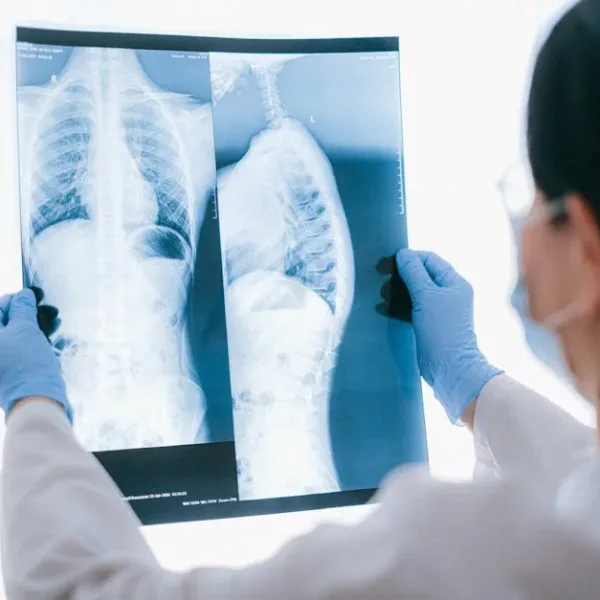 Can AI outperform radiologists at certain tumor-detection benchmarks?