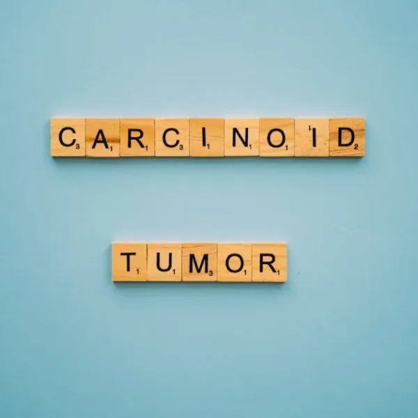 Can AI diagnose certain rare diseases from electronic health records?