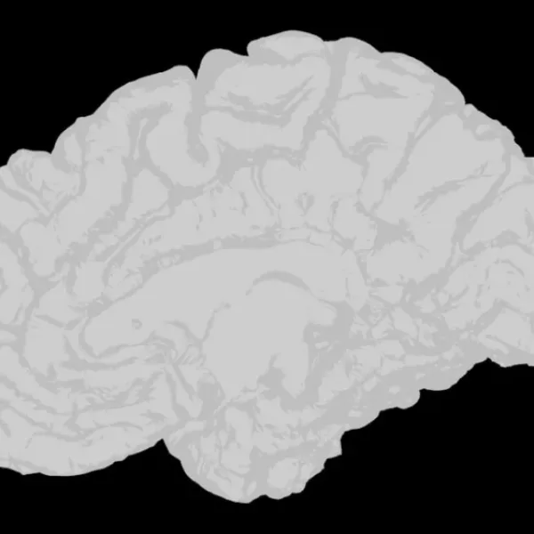 Can AI detect early-stage alzheimer's from speech samples?