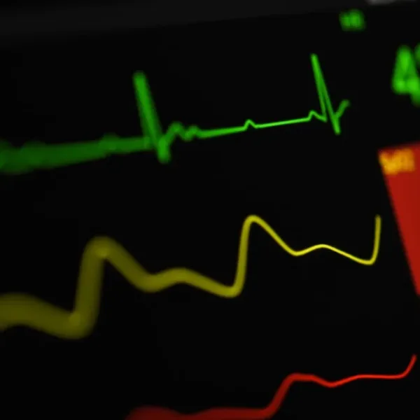 Může AI předpovídat riziko hospitalizace pro srdeční selhání pomocí dat z EKG generovaných pacienty prostřednictvím chytrých hodinek?