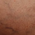 detect certain diseases by looking at images of skin