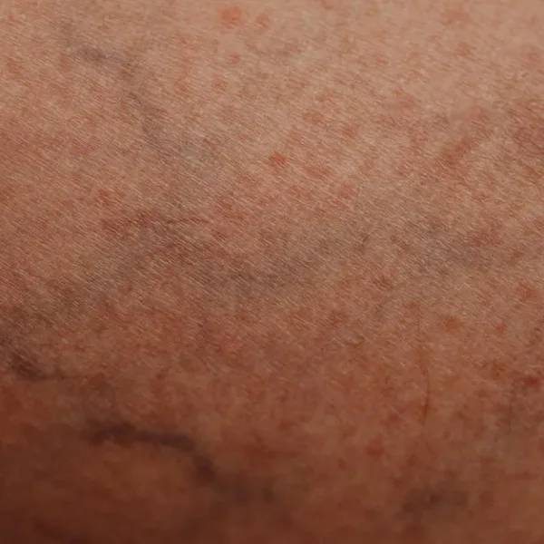 Can AI detect certain diseases by looking at images of skin?