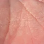 detect certain diseases by looking at images of skin
