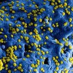 predict the spread of an infectious disease in real time