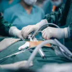 provide help in remote control robotic surgery and correct the surgeon that is managing the controls in real time